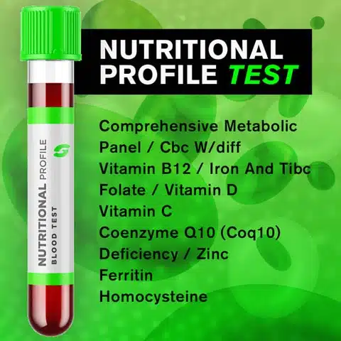 Nutricional Profile